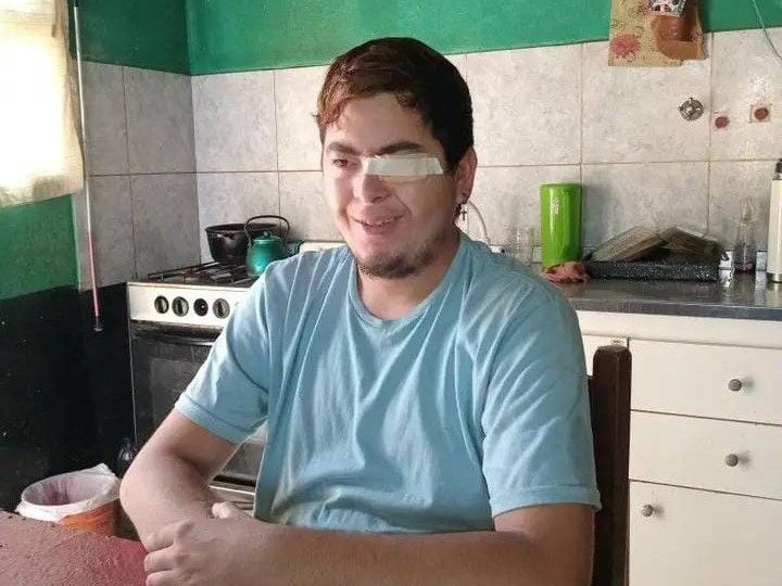 La familia de Lucas Cardozo continúa recaudando fondos para su prótesis ocular